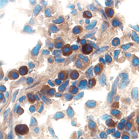 IL-15 was detected in immersion fixed frozen sections of mouse intestine (Peyer patch) using Goat Anti-Mouse IL-15 Antigen Affinity-purified Polyclonal Antibody (Catalog # AF447) at 15 µg/mL overnight at 4 °C. Tissue was stained using the Anti-Goat HRP-DAB Cell & Tissue Staining Kit (brown; Catalog # CTS008) and counterstained with hematoxylin (blue). Specific labeling was localized to the cytoplasm of lymphocytes in villi. View our protocol for Chromogenic IHC Staining of Frozen Tissue Sections.