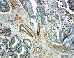Immunohistochemistry IL-15R alpha Antibody [Unconjugated]