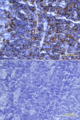 Immunohistochemistry IL-16 Antibody [Unconjugated] - C-terminal Peptide