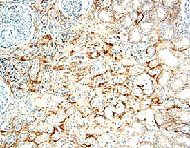 Immunohistochemistry IL-17RB Antibody