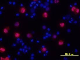 IL-1a/IL-1F1 was detected in immersion fixed human peripheral blood mononuclear cells (PBMCs) stimulated with LPS and monensin using Human IL-1a/IL-1F1 Biotinylated Antigen Affinity-purified Polyclonal Antibody (Catalog # BAF200) at 10 µg/mL for 3 hours at room temperature. Cells were stained using the NorthernLights™ 557-conjugated Anti-Goat IgG Secondary Antibody (red; Catalog # NL001) and counterstained with DAPI (blue). View our protocol for Fluorescent ICC Staining of Non-adherent Cells.