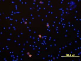 IL-1a/IL-1F1 was detected in immersion fixed human peripheral blood mononuclear cells (PBMCs) stimulated with LPS and monensin using Human IL-1a/IL-1F1 Biotinylated Antigen Affinity-purified Polyclonal Antibody (Catalog # BAF200) at 10 µg/mL for 3 hours at room temperature. Cells were stained using the NorthernLights™ 557-conjugated Streptavidin (yellow; Catalog # NL999) and counterstained with DAPI (blue). View our protocol for Fluorescent ICC Staining of Non-adherent Cells.