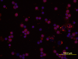 IL-1a/IL-1F1 was detected in immersion fixed human peripheral blood mononuclear cells (PBMCs) using 10 µg/mL Human IL-1a/IL-1F1 Monoclonal Antibody (Catalog # MAB200) for 3 hours at room temperature. Cells were stained with the NorthernLights™ 557-conjugated Anti-Mouse IgG Secondary Antibody (red; Catalog # NL007) and counterstained with DAPI (blue). View our protocol for Fluorescent ICC Staining of Non-adherent Cells.