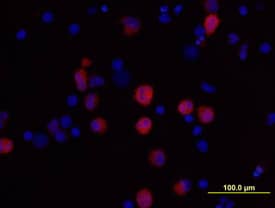 <b>Biological Strategies Validation. </b>IL-1 beta /IL-1F2 was detected in immersion fixed human peripheral blood mononuclear cells (PBMCs) treated with LPS and monensin using Goat Anti-Human IL-1 beta /IL-1F2 Antigen Affinity-purified Polyclonal Antibody (Catalog # AF-201-NA) at 10 µg/mL for 3 hours at room temperature. Cells were stained using the NorthernLights™ 557-conjugated Anti-Goat IgG Secondary Antibody (red; Catalog # NL001) and counterstained with DAPI (blue). View our protocol for Fluorescent ICC Staining of Cells on Coverslips.