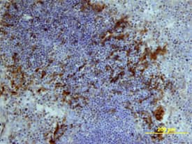IL-1 beta /IL-1F2 was detected in perfusion fixed frozen sections of mouse thymus using Goat Anti-Mouse IL-1 beta /IL-1F2 Antigen Affinity-purified Polyclonal Antibody (Catalog # AF-401-NA) at 15 µg/mL overnight at 4 °C. Tissue was stained using the Anti-Goat HRP-DAB Cell & Tissue Staining Kit (brown; CTS008) and counterstained with hematoxylin (blue). View our protocol for Chromogenic IHC Staining of Frozen Tissue Sections.