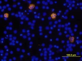 IL-1 beta /IL-1F2 was detected in immersion fixed human peripheral blood mononuclear cells (PBMCs) using Human IL-1 beta /IL-1F2 Biotinylated Antigen Affinity-purified Polyclonal Antibody (Catalog # BAF201) at 10 µg/mL for 3 hours at room temperature. Cells were stained using the NorthernLights™ 557-conjugated Anti-Goat IgG Secondary Antibody (yellow; Catalog # NL001) and counterstained with DAPI (blue). View our protocol for Fluorescent ICC Staining of Non-adherent Cells.
