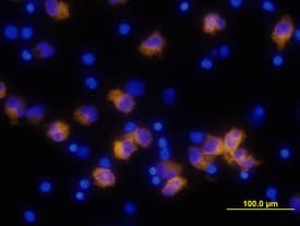 <b>Biological Strategies Validation. </b>IL-1 beta /IL-1F2 was detected in immersion fixed human peripheral blood mononuclear cells (PBMCs) treated with LPS and monensin using Human IL-1 beta /IL-1F2 Monoclonal Antibody (Catalog # MAB201) at 10 µg/mL for 3 hours at room temperature. Cells were stained using the NorthernLights™ 557-conjugated Anti-Mouse IgG Secondary Antibody (yellow; Catalog # NL007) and counterstained with DAPI (blue). View our protocol for Fluorescent ICC Staining of Non-adherent Cells.