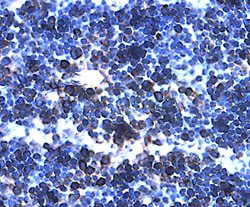 IL-27 p28/IL-30 was detected in perfusion fixed paraffin-embedded sections of mouse thymus using 15 µg/mL Mouse IL-27 p28/ IL-30 Antigen Affinity-purified Polyclonal Antibody (Catalog # AF1834) overnight at 4 °C. Tissue was stained with the Anti-Goat HRP-DAB Cell & Tissue Staining Kit (brown; Catalog # CTS008) and counterstained with hematoxylin (blue). View our protocol for Chromogenic IHC Staining of Paraffin-embedded Tissue Sections.