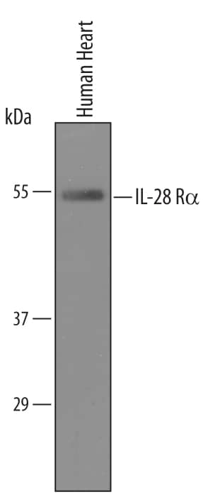 Western Blot IL-28R alpha/IFN-lambda R1 Antibody [Unconjugated]