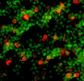 CD25/IL-2 Ra was detected in immersion fixed frozen sections of mouse spleen using 5 µg/mL Goat Anti-Mouse CD25/IL-2 Ra Antigen Affinity-purified Polyclonal Antibody (Catalog # AF2438) overnight at 4 °C. Tissue was stained with the NorthernLights™ 557-conjugated Anti-Goat IgG Secondary Antibody (red; NL001) and counterstained (green). View our protocol for Fluorescent IHC Staining of Frozen Tissue Sections.