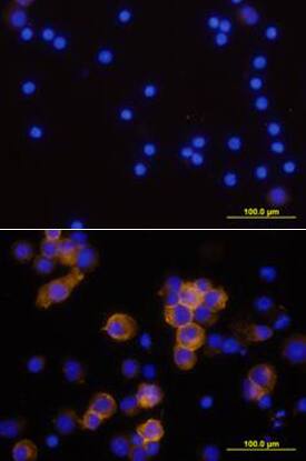 CD25/IL-2 Ra was detected in immersion fixed human peripheral blood mononuclear cells (PBMCs) stimulated with PHA and monensin using Mouse Anti-Human CD25/IL-2 Ra Monoclonal Antibody (Catalog # MAB223) at 10 µg/mL for 3 hours at room temperature. Cells were stained using the NorthernLights™ 557-conjugated Anti-Mouse IgG Secondary Antibody (yellow; Catalog # NL007) and counterstained with DAPI (blue). View our protocol for Fluorescent ICC Staining of Non-adherent Cells.
