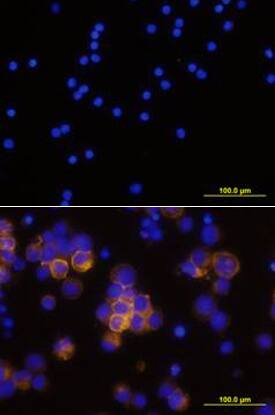 CD25/IL-2 Ra was detected in immersion fixed human peripheral blood mononuclear cells (PBMCs) stimulated with PHA using Mouse Anti-Human CD25/IL-2 Ra Monoclonal Antibody (Catalog # MAB623) at 10 µg/mL for 3 hours at room temperature. Cells were stained using the NorthernLights™ 557-conjugated Anti-Mouse IgG Secondary Antibody (yellow; Catalog # NL007) and counterstained with DAPI (blue). Upper panel shows a lack of labeling if primary antibodies are omitted and tissue is stained only with secondary antibody followed by incubation with detection reagents. View our protocol for Fluorescent ICC Staining of Non-adherent Cells.