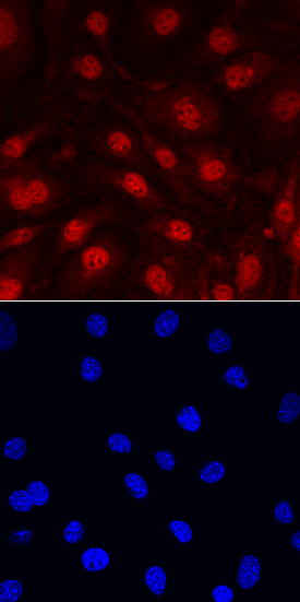 IL-33 was detected in immersion fixed bEnd.3 mouse endothelioma cell line using Goat Anti-Mouse IL-33 Antigen Affinity-purified Polyclonal Antibody (Catalog # AF3626) at 10 µg/mL for 3 hours at room temperature. Cells were stained using the NorthernLights™ 557-conjugated Anti-Goat IgG Secondary Antibody (red, upper panel; Catalog # NL001) and counterstained with DAPI (blue, lower panel). View our protocol for Fluorescent ICC Staining of Cells on Coverslips.