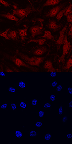 IL‑33 was detected in immersion fixed bEnd.3 mouse endothelioma cell line using Sheep Anti-Mouse IL‑33 Propeptide Antigen Affinity-purified Polyclonal Antibody (Catalog # AF5010) at 10 &micro;g/mL for 3 hours at room temperature. Cells were stained using the NorthernLights&trade; 557-conjugated Anti-Sheep IgG Secondary Antibody (red, upper panel; Catalog # NL010) and counterstained with DAPI (blue, lower panel). View our protocol for Fluorescent ICC Staining of Cells on Coverslips.