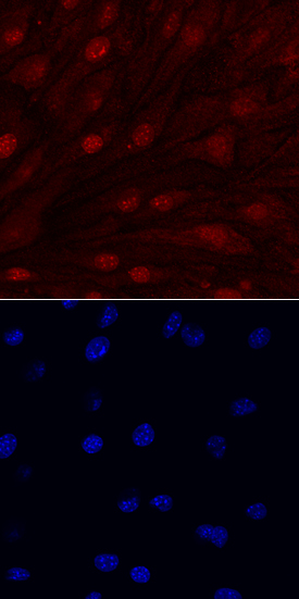 IL-33 was detected in immersion fixed bEnd.3 mouse endothelioma cell line using Rat Anti-Mouse IL-33 Monoclonal Antibody (Catalog # MAB3626) at 10 µg/mL for 3 hours at room temperature. Cells were stained using the NorthernLights™ 557-conjugated Anti-Rat IgG Secondary Antibody (red, upper panel, Catalog # NL013) and counterstained with DAPI (blue, lower panel). View our protocol for Fluorescent ICC Staining of Cells on Coverslips.