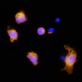 IL-3 was detected in immersion fixed rat splenocytes using Goat Anti-Rat IL-3 Antigen Affinity-purified Polyclonal Antibody (Catalog # AF2524) at 15 µg/mL for 3 hours at room temperature. Cells were stained using the NorthernLights™ 557-conjugated Anti-Goat IgG Secondary Antibody (yellow; Catalog # NL001) and counterstained with DAPI (blue). Specific staining was localized to cytoplasm. View our protocol for Fluorescent ICC Staining of Non-adherent Cells.