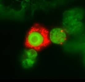 Immunocytochemistry IL-3R alpha/CD123 Antibody (32703) [Unconjugated]