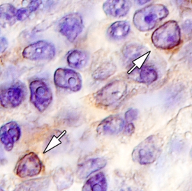Immunohistochemistry IL-3R alpha/CD123 Antibody (32703) [Unconjugated]