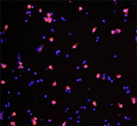 IL-4 was detected in immersion fixed porcine peripheral blood mononuclear cells (PBMCs) using Goat Anti-Porcine IL-4 Antigen Affinity-purified Polyclonal Antibody (Catalog # AF654) at 5 µg/mL for 3 hours at room temperature. Cells were stained using the NorthernLights™ 557-conjugated Anti-Goat IgG Secondary Antibody (red; Catalog # NL001) and counterstained with DAPI (blue). Specific staining was localized to cytoplasm. View our protocol for Fluorescent ICC Staining of Non-adherent Cells.