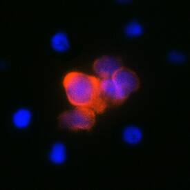 IL-4 was detected in immersion fixed bovine peripheral blood mononuclear cells (PBMCs) stimulated with concanavalin A using Mouse Anti-Bovine IL-4 Monoclonal Antibody (Catalog # MAB2469) at 25 µg/mL for 3 hours at room temperature. Cells were stained using the NorthernLights™ 557-conjugated Anti-Mouse IgG Secondary Antibody (red; Catalog # NL007) and counterstained with DAPI (blue). Specific staining was localized to cell cytoplasm. View our protocol for Fluorescent ICC Staining of Non-adherent Cells.