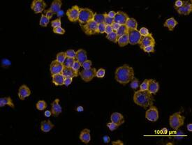 IL-4 was detected in immersion fixed human peripheral blood mononuclear cells (PBMCs) stimulated with PHA using Mouse Anti-Human IL-4 Monoclonal Antibody (Catalog # MAB304) at 10 µg/mL for 3 hours at room temperature. Cells were stained using the NorthernLights™ 557-conjugated Anti-Mouse IgG Secondary Antibody (yellow; Catalog # NL007) and counterstained with DAPI (blue). View our protocol for Fluorescent ICC Staining of Non-adherent Cells.