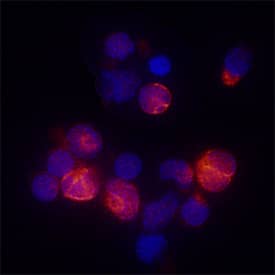 IL-4 Ra was detected in immersion fixed unstimulated human peripheral blood mononuclear cells (PBMCs) using Sheep Anti-Human IL-4 Ra Antigen Affinity-purified Polyclonal Antibody (Catalog # AF6844) at 5 µg/mL for 3 hours at room temperature. Cells were stained using the NorthernLights™ 557-conjugated Anti-Sheep IgG Secondary Antibody (red; Catalog # NL010) and counterstained with DAPI (blue). Specific staining was localized to plasma membranes. View our protocol for Fluorescent ICC Staining of Non-adherent Cells.