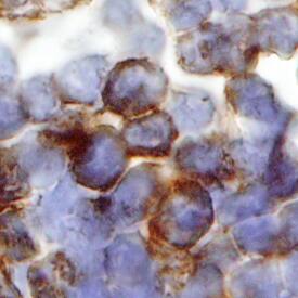 IL-4 Ra was detected in immersion fixed paraffin-embedded sections of human lymph node using Mouse Anti-Human IL-4 Ra Monoclonal Antibody (Catalog # MAB230) at 25 µg/mL overnight at 4 °C. Tissue was stained using the Anti-Mouse HRP-DAB Cell & Tissue Staining Kit (brown; Catalog # CTS002) and counterstained with hematoxylin (blue). Specific staining was localized to plasma cells. View our protocol for Chromogenic IHC Staining of Paraffin-embedded Tissue Sections.