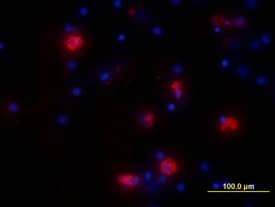 IL-6 was detected in immersion fixed human peripheral blood mononuclear cells (PBMCs) treated with LPS and monensin using Goat Anti-Human IL-6 Antigen Affinity-purified Polyclonal Antibody (Catalog # AF-206-NA) at 10 µg/mL for 3 hours at room temperature. Cells were stained using the NorthernLights™ 557-conjugated Anti-Goat IgG Secondary Antibody (red; Catalog # NL001) and counter-stained with DAPI (blue). View our protocol for Fluorescent ICC Staining of Non-adherent Cells.