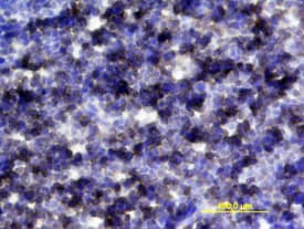IL-6R alpha was detected in perfusion fixed frozen sections of mouse thymus using Mouse IL-6R alpha Antigen Affinity-purified Polyclonal Antibody (Catalog # AF1830) at 15 µg/mL overnight at 4 °C. Tissue was stained using the Anti-Goat HRP-DAB Cell & Tissue Staining Kit (brown; Catalog # CTS008) and counterstained with hematoxylin (blue). View our protocol for Chromogenic IHC Staining of Frozen Tissue Sections.