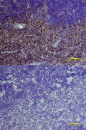 IL-6R alpha was detected in perfusion fixed frozen sections of mouse thymus using Mouse IL-6R alpha Antigen Affinity-purified Polyclonal Antibody (Catalog # AF1830) at 15 µg/mL overnight at 4 °C. Tissue was stained using the Anti-Goat HRP-DAB Cell & Tissue Staining Kit (brown; Catalog # CTS008) and counterstained with hematoxylin (blue). Lower panel shows a lack of labeling if primary antibodies are omitted and tissue is stained only with secondary antibody followed by incubation with detection reagents. View our protocol for Chromogenic IHC Staining of Frozen Tissue Sections.