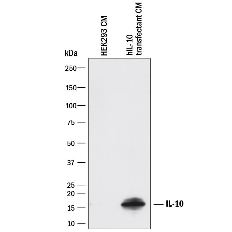 Western blot shows conditioned media of HEK293 human embryonic kidney cell line either mock transfected or transfected with human IL-10. PVDF membrane was probed with 1 µg/mL of Goat Anti-Human IL-10 Polyclonal Antibody (Catalog # AB-217-NA) followed by HRP-conjugated Anti-Goat IgG Secondary Antibody (Catalog # HAF017). A specific band was detected for IL-10 at approximately 16 kDa (as indicated). This experiment was conducted under reducing conditions and using Immunoblot Buffer Group 1.
