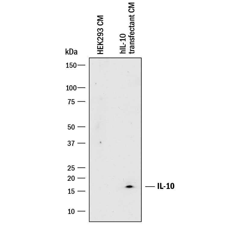 Western blot shows conditioned media of HEK293 human embryonic kidney cell line either mock transfected or transfected with human IL-10. PVDF membrane was probed with 5 µg/mL of Mouse Anti-Human IL-10 Monoclonal Antibody (Catalog # MAB2171) followed by HRP-conjugated Anti-Mouse IgG Secondary Antibody (Catalog # HAF018). A specific band was detected for IL-10 at approximately 16 kDa (as indicated). This experiment was conducted under reducing conditions and using Immunoblot Buffer Group 1.