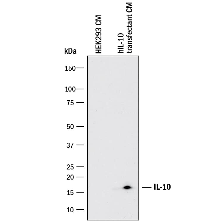 Western blot shows conditioned media of HEK293 human embryonic kidney cell line either mock transfected or transfected with human IL-10. PVDF membrane was probed with 5 µg/mL of Mouse Anti-Human IL-10 Monoclonal Antibody (Catalog # MAB2172) followed by HRP-conjugated Anti-Mouse IgG Secondary Antibody (Catalog # HAF018). A specific band was detected for IL-10 at approximately 16 kDa (as indicated). This experiment was conducted under reducing conditions and using Immunoblot Buffer Group 1.