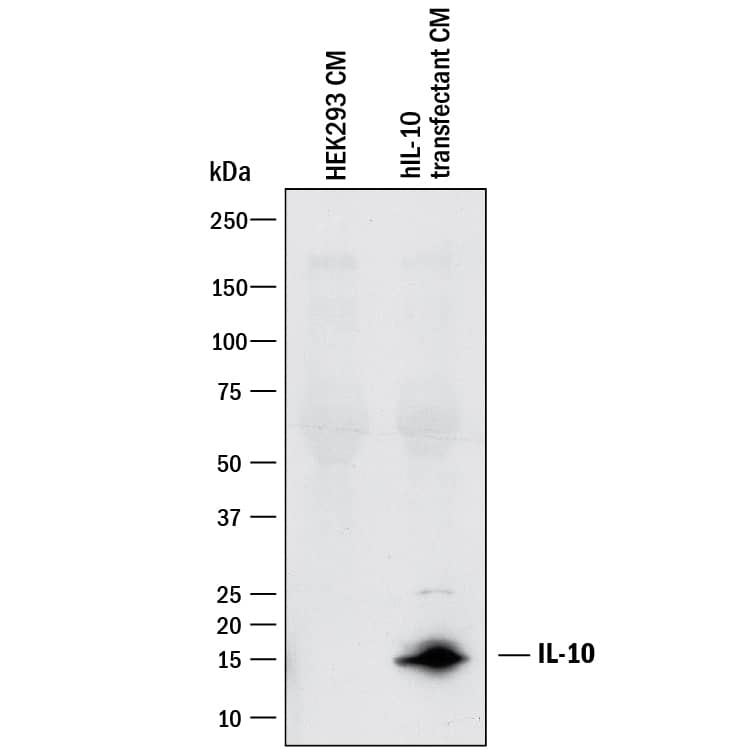 Western Blot IL-10 Antibody (23738) [Unconjugated]