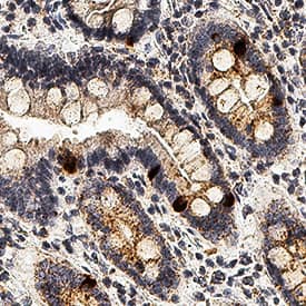 IL-10 was detected in immersion fixed paraffin-embedded sections of human duodenum using Rabbit Anti-Human IL-10 Monoclonal Antibody (Catalog # MAB91842) at 3 µg/mL for 1 hour at room temperature followed by incubation with the Anti-Rabbit IgG VisUCyte™ HRP Polymer Antibody (Catalog # VC003). Before incubation with the primary antibody, tissue was subjected to heat-induced epitope retrieval using Antigen Retrieval Reagent-Basic (Catalog # CTS013). Tissue was stained using DAB (brown) and counterstained with hematoxylin (blue). Specific staining was localized to cytoplasm in enteroendocrine cells of duodenum. View our protocol for IHC Staining with VisUCyte HRP Polymer Detection Reagents.