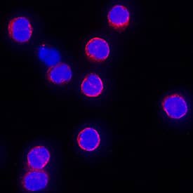 IL-10 was detected in immersion fixed human peripheral blood mononuclear cells (PBMCs) using Mouse Anti-Human IL-10 Monoclonal Antibody (Catalog # MAB9184) at 25 µg/mL for 3 hours at room temperature. Cells were stained using the NorthernLights™ 557-conjugated Anti-Mouse IgG Secondary Antibody (red; Catalog # NL007) and counterstained with DAPI (blue). Specific staining was localized to cytoplasm. View our protocol for Fluorescent ICC Staining of Non-adherent Cells.