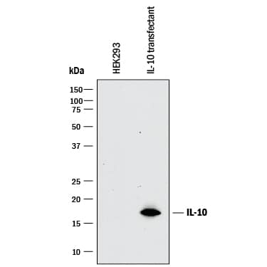 Western blot shows conditioned media from HEK293 human embryonic kidney cell line either mock transfected or transfected human IL-10. PVDF membrane was probed with 2 µg/mL of Mouse Anti-Human IL-10 Monoclonal Antibody (Catalog # MAB9184) followed by HRP-conjugated Anti-Mouse IgG Secondary Antibody (Catalog # HAF018). A specific band was detected for IL-10 at approximately 17 kDa (as indicated). This experiment was conducted under reducing conditions and using Immunoblot Buffer Group 1.