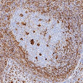 IL-10 was detected in immersion fixed paraffin-embedded sections of human tonil using Rat Anti-Human IL-10 Monoclonal Antibody (Catalog # MAB92101) at 0.5 µg/mL for 1 hour at room temperature followed by incubation with the Anti-Rat IgG VisUCyte™ HRP Polymer Antibody (Catalog # VC005). Before incubation with the primary antibody, tissue was subjected to heat-induced epitope retrieval using Antigen Retrieval Reagent-Basic (Catalog # CTS013). Tissue was stained using DAB (brown) and counterstained with hematoxylin (blue). Specific staining was localized to cytoplasm in lymphocytes. View our protocol for IHC Staining with VisUCyte HRP Polymer Detection Reagents.