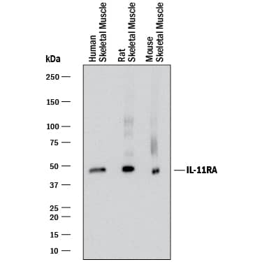 Western blot shows lysates of human skeletal muscle tissue, mouse skeletal muscle tissue, and rat skeletal muslce tissue. PVDF membrane was probed with 2 µg/mL of Mouse Anti-Human IL-11 Ra Monoclonal Antibody (Catalog # MAB19771) followed by HRP-conjugated Anti-Mouse IgG Secondary Antibody (Catalog # HAF018). A specific band was detected for IL-11 Ra at approximately 45-49 kDa (as indicated). This experiment was conducted under reducing conditions and using Immunoblot Buffer Group 1.