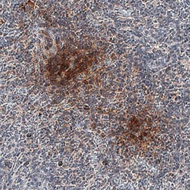 IL-12 p70 was detected in immersion fixed paraffin-embedded sections of human spleen using Mouse Anti-Human IL-12 p70 Monoclonal Antibody (Catalog # MAB219) at 5 µg/mL for 1 hour at room temperature followed by incubation with the Anti-Mouse IgG VisUCyte™ HRP Polymer Antibody (Catalog # VC001). Before incubation with the primary antibody, tissue was subjected to heat-induced epitope retrieval using Antigen Retrieval Reagent-Basic (Catalog # CTS013). Tissue was stained using DAB (brown) and counterstained with hematoxylin (blue). Specific staining was localized to plasma membrane and cytoplasm. View our protocol for IHC Staining with VisUCyte HRP Polymer Detection Reagents.