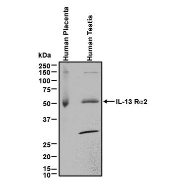 Western blot shows lysates of human placenta tissue and human testis tissue. PVDF membrane was probed with 0.2 µg/mL of Goat Anti-Human IL-13 Ra2 Antigen Affinity-purified Polyclonal Antibody (Catalog # AF146) followed by HRP-conjugated Anti-Goat IgG Secondary Antibody (Catalog # HAF017). A specific band was detected for IL-13 Ra2 at approximately 50-55 kDa (as indicated). This experiment was conducted under reducing conditions and using Immunoblot Buffer Group 1.