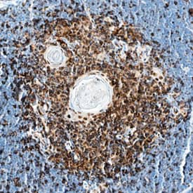 IL-13 Ra2 was detected in perfusion fixed frozen sections of mouse thymus using Goat Anti-Mouse IL-13 Ra2 Antigen Affinity-purified Polyclonal Antibody (Catalog # AF539) at 10 µg/mL overnight at 4 °C. Tissue was stained using the Anti-Goat HRP-DAB Cell & Tissue Staining Kit (brown; Catalog # CTS008) and counterstained with hematoxylin (blue). Specific staining was localized to cytoplasm in lymphocytes. View our protocol for Chromogenic IHC Staining of Frozen Tissue Sections.