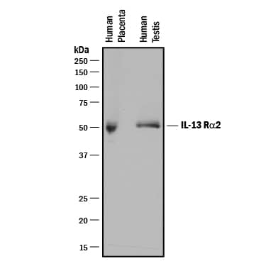 Western blot shows lysates of human placenta tissue and human testis tissue. PVDF membrane was probed with 5 µg/mL of Mouse Anti-Human IL-13 Ra2 Monoclonal Antibody (Catalog # MAB614) followed by HRP-conjugated Anti-Mouse IgG Secondary Antibody (Catalog # HAF018). A specific band was detected for IL-13 Ra2 at approximately 50-55 kDa (as indicated). This experiment was conducted under reducing conditions and using Immunoblot Buffer Group 1.