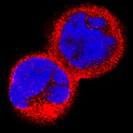 Immunocytochemistry IL-15R alpha Antibody [Unconjugated]