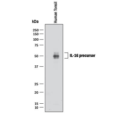 Western blot shows lysate of human tonsil tissue. PVDF membrane was probed with 2 µg/mL of Mouse Anti-Human IL-16 Monoclonal Antibody (Catalog # MAB316) followed by HRP-conjugated Anti-Mouse IgG Secondary Antibody (Catalog # HAF018). Specific bands were detected for IL-16 at approximately 45-55 kDa (as indicated). This experiment was conducted under reducing conditions and using Immunoblot Buffer Group 1.