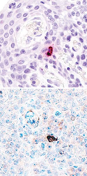 <b>Orthogonal Strategies Validation. </b>IL-17F mRNA was detected in formalin-fixed paraffin-embedded tissue sections of human tonsil probed with ACD RNAScope® Probe (Catalog # 310941) and stained using ACD RNAscope® 2.5 HD Detection Reagents-Red (top image, Catalog # 32260). Adjacent tissue section was processed for immunohistochemistry using R&D Systems Goat Anti-Human IL-17F Antigen Affinity-purified Polyclonal Antibody (Catalog # AF1335) at 3 ug/mL for 1 hour at room temperature followed by incubation with the Anti-Goat IgG VisUCyte HRP Polymer Antibody (R&D Systems, Catalog # VC004) and DAB chromogen (lower image, yellow-brown). Tissues were counterstained with hematoxylin (blue).