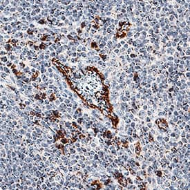 IL-17F was detected in immersion fixed paraffin-embedded sections of human tonsil using Goat Anti-Human/Primate IL-17F Antigen Affinity-purified Polyclonal Antibody (Catalog # AF1335) at 3 µg/mL for 1 hour at room temperature followed by incubation with the Anti-Goat IgG VisUCyte™ HRP Polymer Antibody (Catalog # VC004). Before incubation with the primary antibody, tissue was subjected to heat-induced epitope retrieval using Antigen Retrieval Reagent-Basic (Catalog # CTS013). Tissue was stained using DAB (brown) and counterstained with hematoxylin (blue). Specific staining was localized to extracellular space and plasma membrane. View our protocol for IHC Staining with VisUCyte HRP Polymer Detection Reagents.