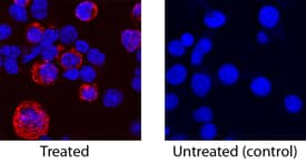 IL-17F was detected in immersion fixed mouse T helper 17 (Th17) cells stimulated with PMA and calcium ionomycin using Goat Anti-Mouse IL-17F Antigen Affinity-purified Polyclonal Antibody (Catalog # AF2057) at 15 µg/mL for 3 hours at room temperature. Cells were stained using the NorthernLights™ 557-conjugated Anti-Goat IgG Secondary Antibody (red; Catalog # NL001) and counterstained with DAPI (blue). Specific staining was localized to cytoplasm. View our protocol for Fluorescent ICC Staining of Non-adherent Cells.