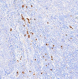 IL-17/IL-17A was detected in immersion fixed paraffin-embedded sections of human tonsil using Goat Anti-Human IL-17/IL-17A Antigen Affinity-purified Polyclonal Antibody (Catalog # AF-317-NA) at 1 µg/mL for 1 hour at room temperature followed by incubation with the Anti-Goat IgG VisUCyte™ HRP Polymer Antibody (VC004). Tissue was stained using DAB (brown) and counterstained with hematoxylin (blue). Specific staining was localized to lymphocytes. View our protocol for IHC Staining with VisUCyte HRP Polymer Detection Reagents.