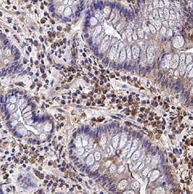IL-17/IL-17A was detected in immersion fixed paraffin-embedded sections of human Crohn's disease intestine using Mouse Anti-Human/Primate IL-17/IL-17A Monoclonal Antibody (Catalog # MAB317) at 5 µg/mL for 1 hour at room temperature followed by incubation with the Anti-Mouse IgG VisUCyte™ HRP Polymer Antibody (Catalog # VC001). Tissue was stained using DAB (brown) and counterstained with hematoxylin (blue). Specific staining was localized to lymphocytes. View our protocol for IHC Staining with VisUCyte HRP Polymer Detection Reagents.